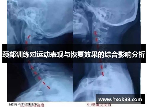颈部训练对运动表现与恢复效果的综合影响分析